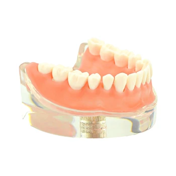 Diş İmplant Restorasyon Diş Modeli Çıkarılabilir Köprü Diş model beyin Diş Enstrüman