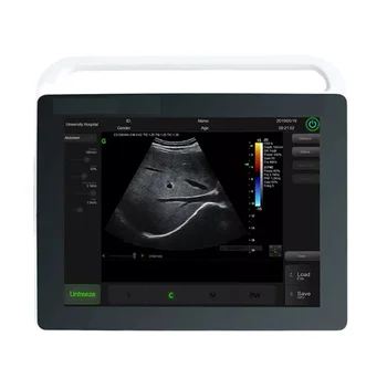 MC101 15.1 inç geniş dokunmatik ekran tablet tipi taşınabilir ultrason tarayıcı gebelik için