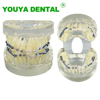 Metal ve Seramik Braketli Diş Ortodonti Modeli Typodont Diş Hekimliği Tedavisi Diş Modeli Hasta İletişimi İçin