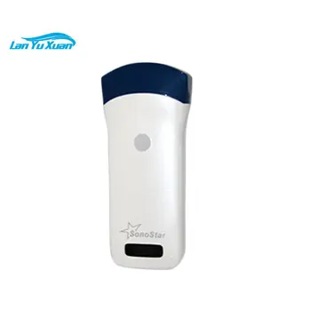 Siyah ve Beyaz Sıcak Satış Tıbbi Mini Wifi El Kablosuz Ultrason Tarayıcı 3'ü 1 arada